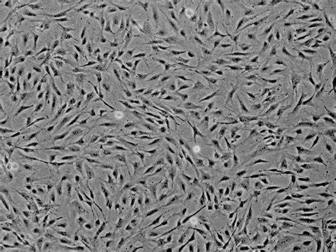 小鼠脾脏免疫细胞分析